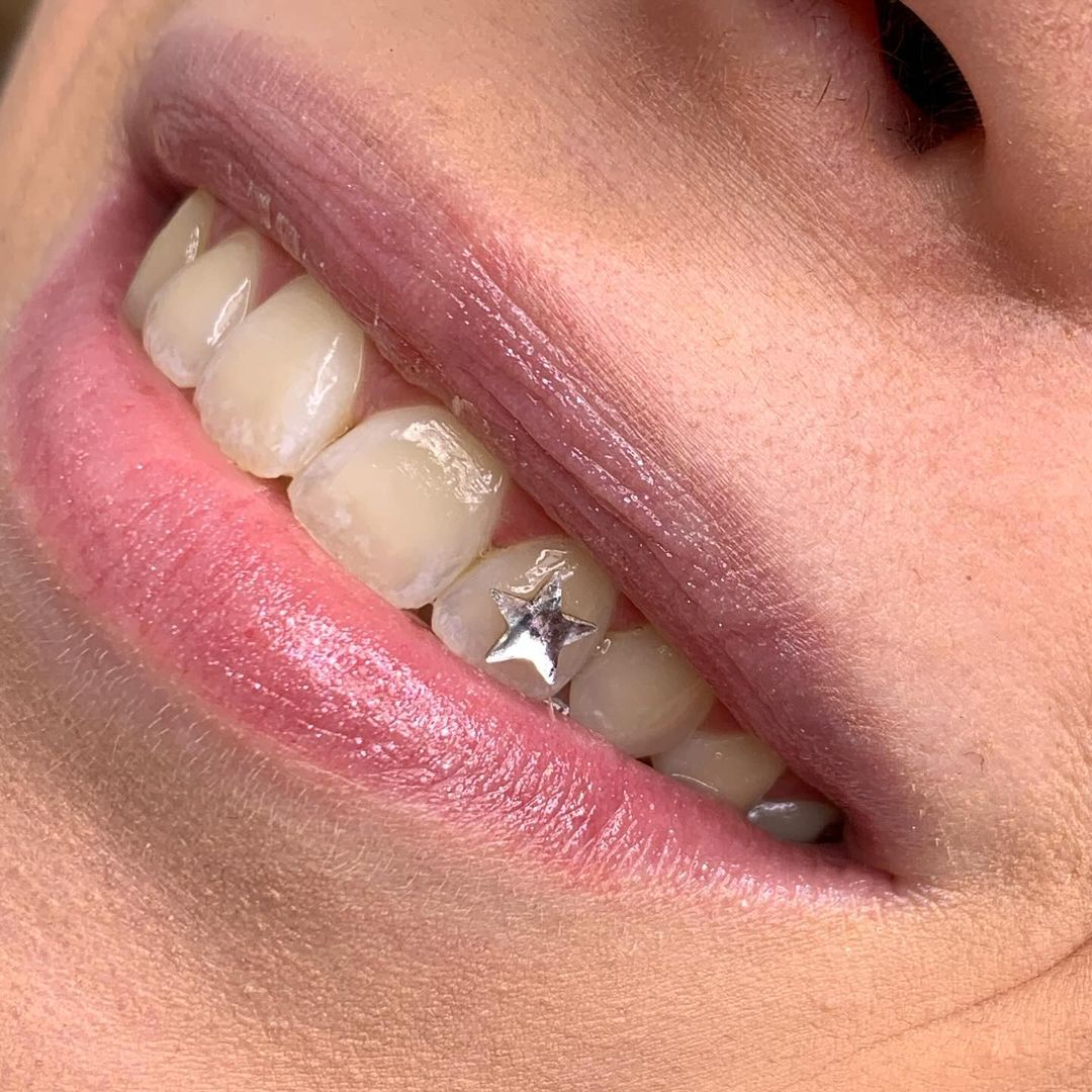 Travail de Lili Gems Strass Dentaire