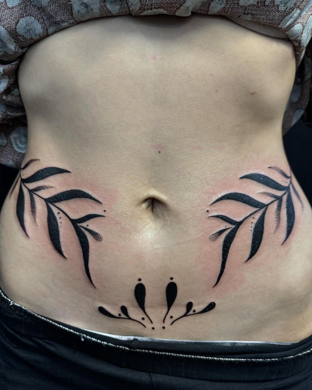 Portfolio de Epidermink