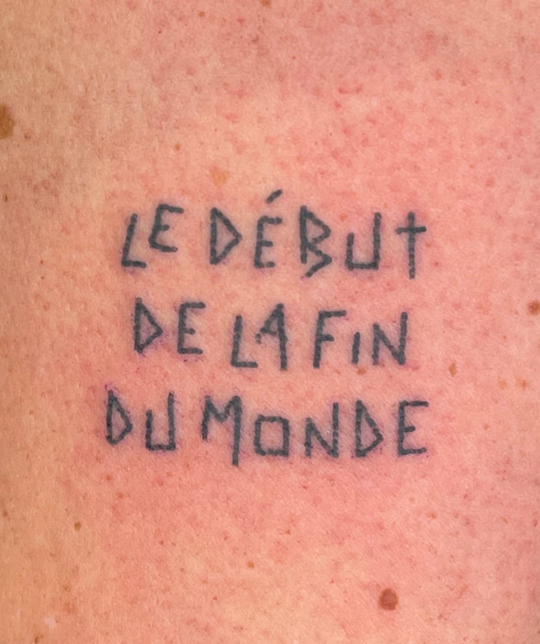Portfolio de Gros Maux