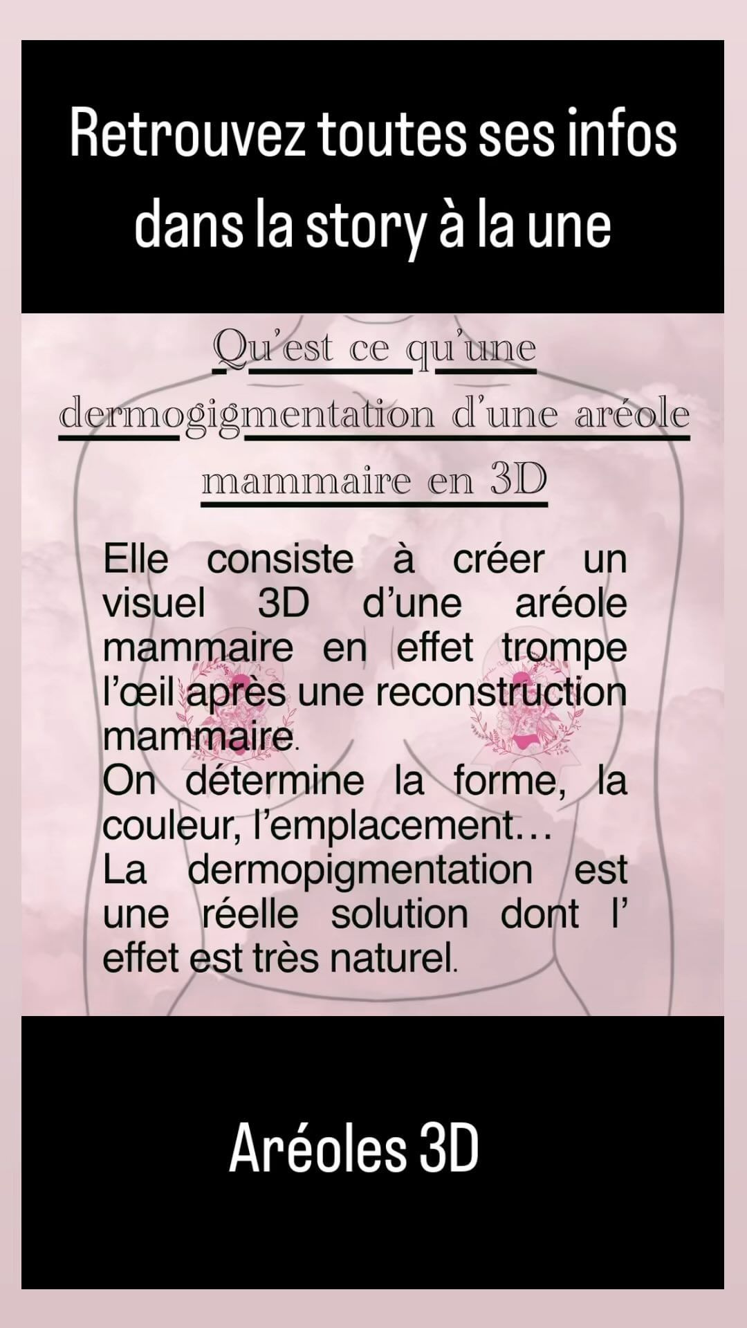 Portfolio de La Cagoule Rose Dᴇʀᴍᴏᴘɪɢᴍᴇɴᴛᴀᴛɪᴏɴ