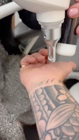 Portfolio de Rudegirls Laser Tattoo Removal