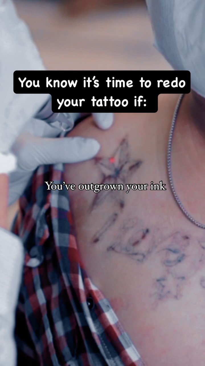Portfolio de Laser Tattoo Removal Aesthetics