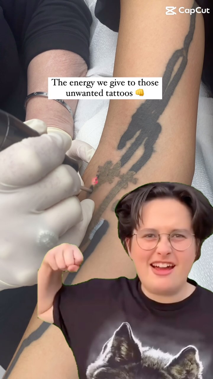 Portfolio de Laser Tattoo Removal Aesthetics