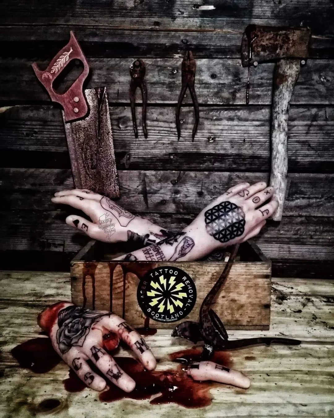 Portfolio de Laser Tattoo Removal Scotland